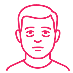 Eye Bags